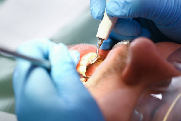 Best Emergency Treatment for Toothache in Monmouth, IL