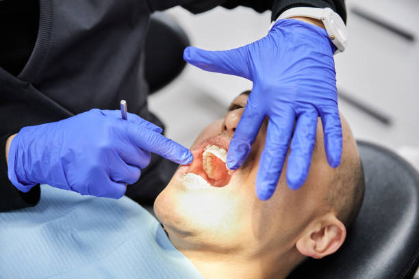 Best Emergency Tooth Extraction in Monmouth, IL