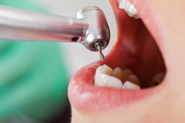 Best Emergency Orthodontic Repairs in Monmouth, IL